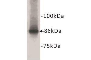Western Blotting (WB) image for anti-Catenin, beta (CATNB) (N-Term) antibody (ABIN1854847)