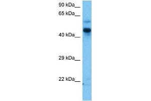 Host:  Mouse  Target Name:  ZIC3  Sample Tissue:  Mouse Brain  Antibody Dilution:  1ug/ml (ZIC3 Antikörper  (N-Term))