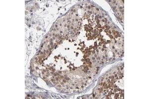 Immunohistochemical staining of human testis with GLCCI1 polyclonal antibody  shows distinct cytoplasmic positivity in primary spermatocytes in seminiferus ducts at 1:50-1:200 dilution. (GLCCI1 Antikörper)