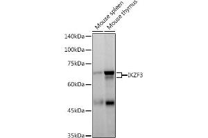 Western blot analysis of extracts of various cell lines, using IKZF3 antibody (ABIN7267842) at 1:500 dilution. (IKZF3 Antikörper)