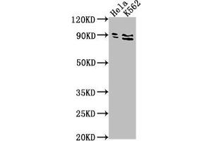 Western Blot Positive WB detected in: Hela whole cell lysate, K562 whole cell lysate All lanes: SUPV3L1 antibody at 1:2000 Secondary Goat polyclonal to rabbit IgG at 1/50000 dilution Predicted band size: 88 kDa Observed band size: 88 kDa (SUPV3L1 Antikörper  (AA 499-786))