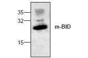 Image no. 1 for anti-BH3 Interacting Domain Death Agonist (BID) antibody (ABIN127071) (BID Antikörper)