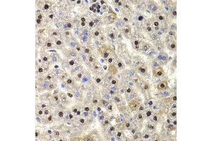 Immunohistochemistry of paraffin-embedded rat liver using HIRIP3 antibody at dilution of 1:100 (x400 lens). (HIRIP3 Antikörper)