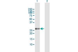 Western Blot analysis of AK3 expression in transfected 293T cell line by AK3 MaxPab polyclonal antibody.