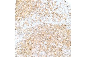 Immunohistochemistry (IHC) image for anti-CD22 Molecule (CD22) (AA 20-687) antibody (ABIN7453999)