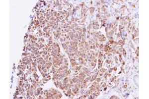 Immunohistochemistry (IHC) image for anti-Guanine Nucleotide Binding Protein, alpha Stimulating, Olfactory Type (GNAL) (Center) antibody (ABIN2855716)