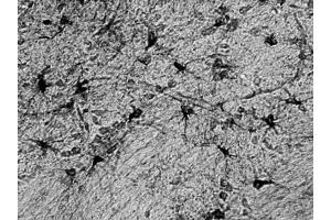 Adult rat hippocampus immunohistochemistry.