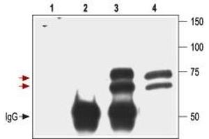 Immunoprecipitation of 3T3/p75NTR transfected cells: - 1.