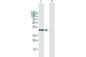 Western Blot analysis of RPLP0 expression in transfected 293T cell line by RPLP0 MaxPab polyclonal antibody. (RPLP0 Antikörper  (AA 1-317))
