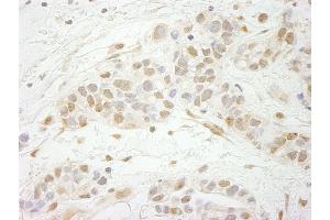 Immunohistochemistry (IHC) image for anti-Metastasis Associated 1 Family, Member 3 (MTA3) (AA 400-450) antibody (ABIN7448677) (MTA3 Antikörper  (AA 400-450))