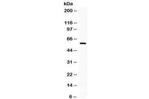 Western blot testing of human HeLa cell lysate with IKAROS antibody. (IKZF1 Antikörper)