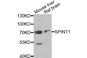 Western blot analysis of extracts of various cell lines, using SPINT1 antibody (ABIN5973812) at 1/1000 dilution. (SPINT1 Antikörper)