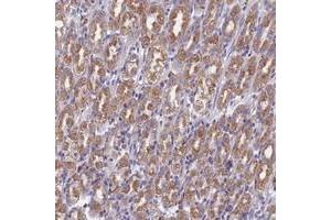 Immunohistochemical staining of human stomach with DDX51 polyclonal antibody  shows moderate cytoplasmic positivity in tubular cells at 1:50-1:200 dilution. (DDX51 Antikörper)