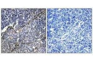 Immunohistochemistry analysis of paraffin-embedded human thymus gland tissue using Collagen XIX α1 antibody. (COL19A1 Antikörper)
