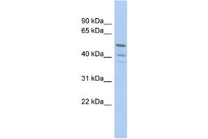 WB Suggested Anti-TRIM50 Antibody Titration:  0. (TRIM50 Antikörper  (Middle Region))
