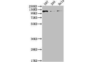 Western Blot Positive WB detected in: U87 whole cell lysate, 293 whole cell lysate, Hela whole cell lysate All lanes: FGFR3 antibody at 1:2000 Secondary Goat polyclonal to rabbit IgG at 1/50000 dilution Predicted band size: 88, 89, 76, 86 kDa Observed band size: 115 kDa (Rekombinanter FGFR3 Antikörper)