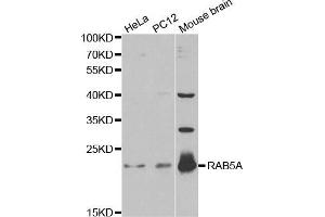 Western blot analysis of extracts of various cell lines, using RAB5A antibody (ABIN5970526) at 1/1000 dilution. (RAB5 Antikörper)