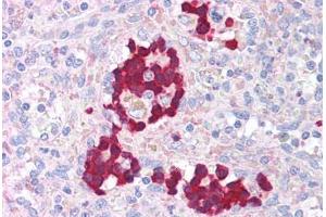 Human Spleen (formalin-fixed, paraffin-embedded) stained with AURKB antibody ABIN214031 at 5 ug/ml followed by biotinylated goat anti-rabbit IgG secondary antibody ABIN481713, alkaline phosphatase-streptavidin and chromogen. (Aurora Kinase B Antikörper  (AA 227-238))