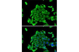 Immunofluorescence analysis of MCF7 cells using RPS14 antibody (ABIN6129109, ABIN6147198, ABIN6147199 and ABIN6222448). (RPS14 Antikörper  (AA 1-151))