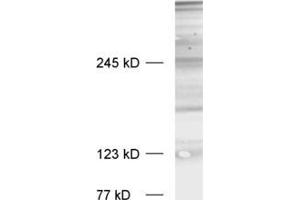 dilution: 1 : 1000, sample: crude synaptosomal fraction of rat brain (P2) (Bassoon Antikörper  (C-Term))