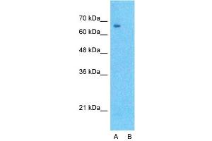 Host:  Rabbit  Target Name:  DLL1  Sample Type:  Hela  Lane A:  Primary Antibody  Lane B:  Primary Antibody + Blocking Peptide  Primary Antibody Concentration:  1ug/ml  Peptide Concentration:  5ug/ml  Lysate Quantity:  25ug/lane/lane  Gel Concentration:  0.