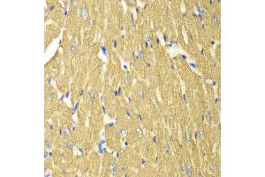 Immunohistochemistry of paraffin-embedded mouse heart using TPM3 antibody at dilution of 1:100 (400x lens). (TPM3 Antikörper)