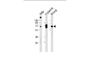 All lanes : Anti-LGALS3BP Antibody (Center) at 1:2000 dilution Lane 1: Hela whole cell lysate Lane 2: Human plasma lysate Lane 3: Mouse lung lysate Lysates/proteins at 20 μg per lane.