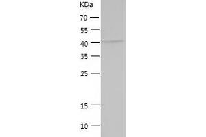 Western Blotting (WB) image for KIAA0513 (KIAA0513) (AA 1-401) protein (His tag) (ABIN7284525) (KIAA0513 Protein (KIAA0513) (AA 1-401) (His tag))