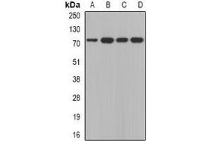 Western blot analysis of Calpain 5 expression in A431 (A), SKOV3 (B), mouse thymus (C), mouse brain (D) whole cell lysates.