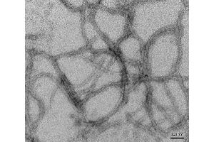 Electron Microscopy (EM) image for tau Protein (partial), (Pro301Leu-Mutant) (Active) protein (ABIN6929400)