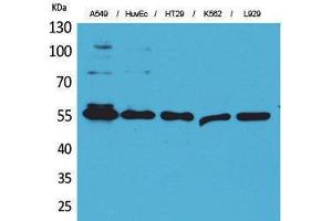 Western Blotting (WB) image for anti-Fascin (FSCN1) (Internal Region) antibody (ABIN3187747) (Fascin Antikörper  (Internal Region))