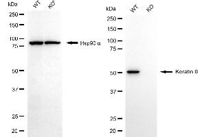 Western blotting analysis using keratin 8 antibody (ABIN7799189).