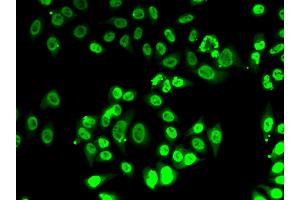 Immunofluorescence analysis of A-549 cells using FIP1L1 antibody (ABIN6131645, ABIN6140640, ABIN6140641 and ABIN6222954).