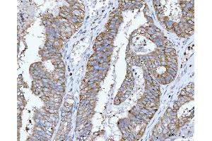 IHC analysis of RPL32 using anti-RPL32 antibody (ABIN7602916). (RPL32 Antikörper  (C-Term))