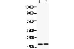 Anti- CASP8 antibody, Western blotting All lanes: Anti CASP8  at 0. (Caspase 8 Antikörper  (N-Term))