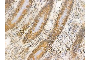 ABIN6262097 and ABIN6266556 at 1/100 staining human normal colon tissue by IHC-P. (HSPA9 Antikörper  (C-Term))