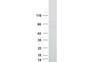 Western Blotting (WB) image for Baculoviral IAP Repeat Containing 3 (BIRC3) (Transcript Variant 1) protein (Myc-DYKDDDDK Tag) (ABIN2723206)