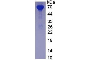 SDS-PAGE (SDS) image for Albumin (ALB) protein (ABIN1877209) (Albumin Protein (ALB))