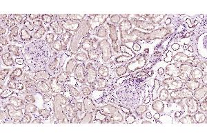 Immunohistochemistry (Paraffin-embedded Sections) (IHC (p)) image for anti-C-Type Lectin Domain Family 9, Member A (CLEC9A) (AA 101-200) antibody (ABIN1713465)