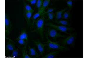 Immunofluorescence microscopy of Rabbit Anti-alpha-Tubulin antibody using HeLa cells fixed with PFA. (alpha Tubulin Antikörper  (Internal Region))
