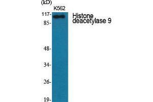 Western Blot (WB) analysis of specific cells using Histone deacetylase 9 Polyclonal Antibody. (HDAC9 Antikörper  (C-Term))