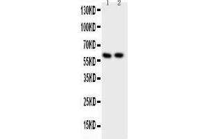 Anti-Src Picoband antibody,  All lanes: Anti-Src at 0.