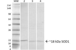 Western blot analysis of Human, Rat, Mouse Hela cells, Brain, Lung showing detection of ~18 kDa SOD1 (UBB) protein using Rabbit Anti-SOD1 (UBB) Polyclonal Antibody . (SOD1 Antikörper  (N-Term) (Atto 390))