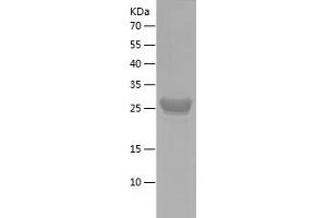 Western Blotting (WB) image for Oligodendrocyte Lineage Transcription Factor 2 (OLIG2) (AA 242-292) protein (His-IF2DI Tag) (ABIN7124256) (OLIG2 Protein (AA 242-292) (His-IF2DI Tag))