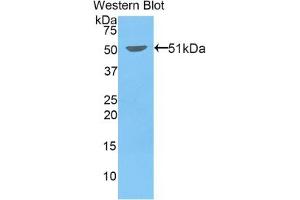 Detection of Recombinant KIF5A, Mouse using Polyclonal Antibody to Kinesin Family, Member 5A (KIF5A) (KIF5A Antikörper  (AA 2-211))