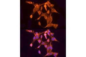 Immunofluorescence analysis of PC-12 cells using ULBP2 Rabbit pAb (ABIN7271214) at dilution of 1:50 (40x lens). (ULBP2 Antikörper  (AA 26-216))