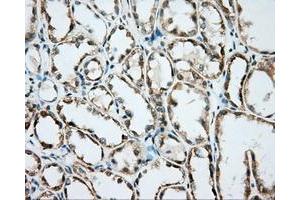Immunohistochemical staining of paraffin-embedded Kidney tissue using anti-BSG mouse monoclonal antibody. (CD147 Antikörper)