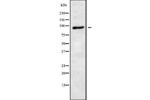 Western blot analysis of ATXN7 using HuvEc whole cell lysates (ATXN7 Antikörper  (Internal Region))