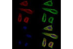 ABIN7094719 and ABIN7098770 staining Hela cells by IF/ICC. (GUCY1A2 Antikörper  (N-Term))