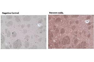 Immunohistochemistry analysis of formalin-fixed, paraffin-embedded rat brain tissue stained with Bassoon monoclonal antibody (SAP7F407),  at 10 μg/mL. (Bassoon Antikörper)